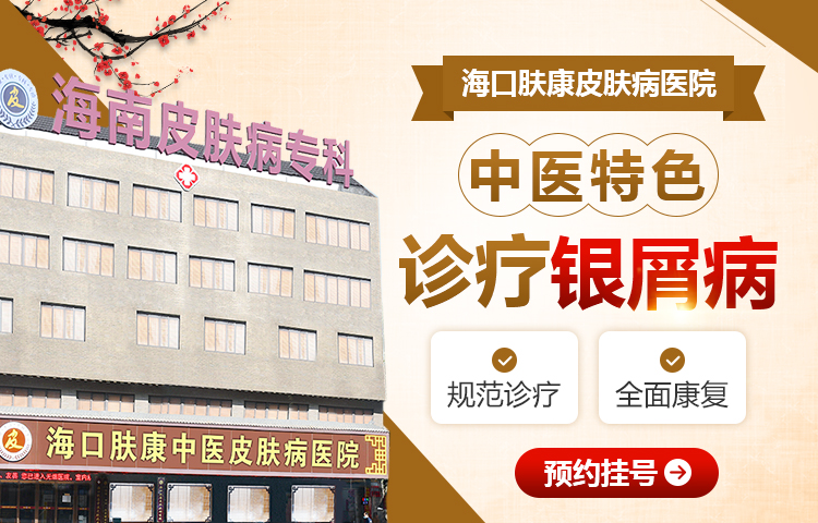 皮肤癣最好治疗方法