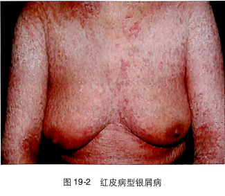 ��������ţƤѢר��_��������ţƤѢҽԺ_ţƤѢ���κ���