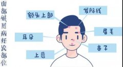 ��������ţƤѢ��ʲô����_����ţƤѢ�������ô�죿