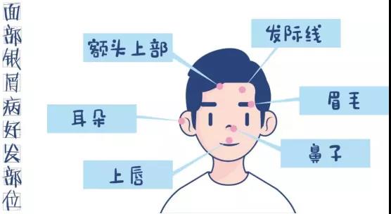 ��������ţƤѢ��ʲô����_����ţƤѢ�������ô��