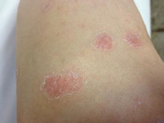 ������ţƤѢר������ҽԺ