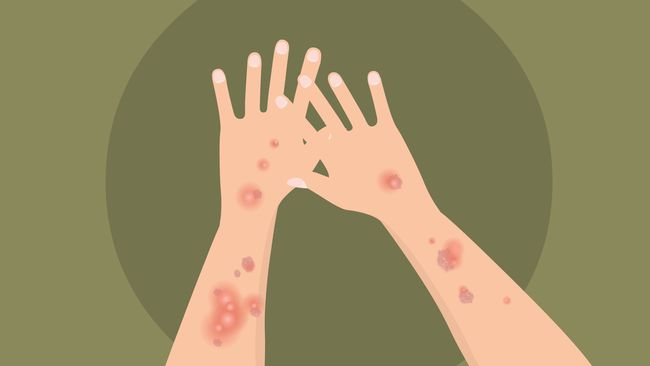 ���ڿ�ţƤѢҽԺ-Ѱ����ţƤѢ������