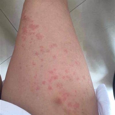 ݡ����ܳ�ʲô-������ݡ����ҽԺ����Щ