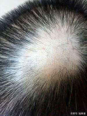 ����ͺ��Ӧ����δ���-������ͺ����ҽԺ����Щ