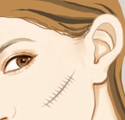 �̺�����Щ����-�����ΰ̺۵�ҽԺ����Щ