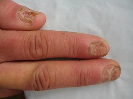 �������Ǹ�ҽԺ�λ�ָ�׺�{�Ȱ�}��ָ�׿���������Щ����