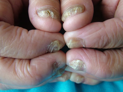 �����ļҿ���ָ�׺�{�Ȱ�}���ȥ��ָ�����